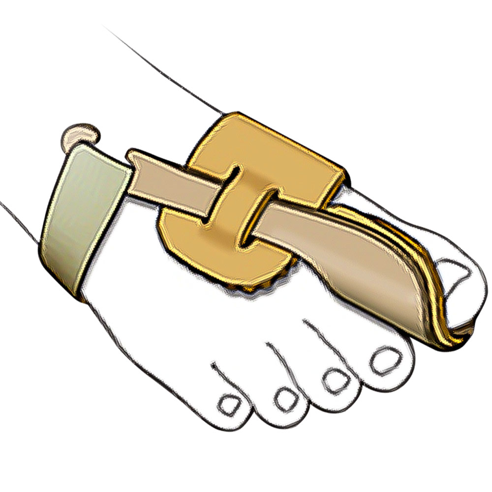 Correttore notturno per alluce valgo